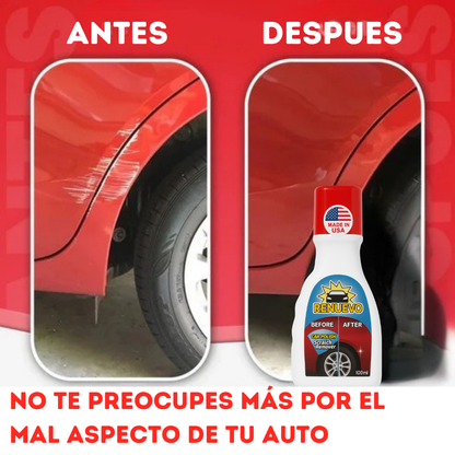 Removedor de Rayones Premium LLEGA A COLOMBIA / RemoverMax™